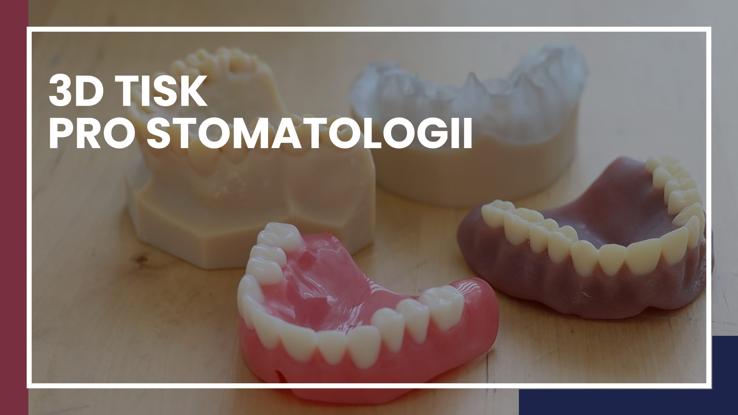 3D tiskárna pro stomatologii