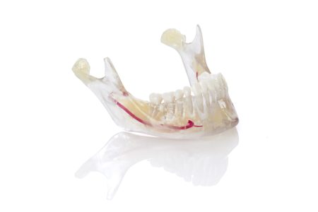 3D tisk pro stomatologii